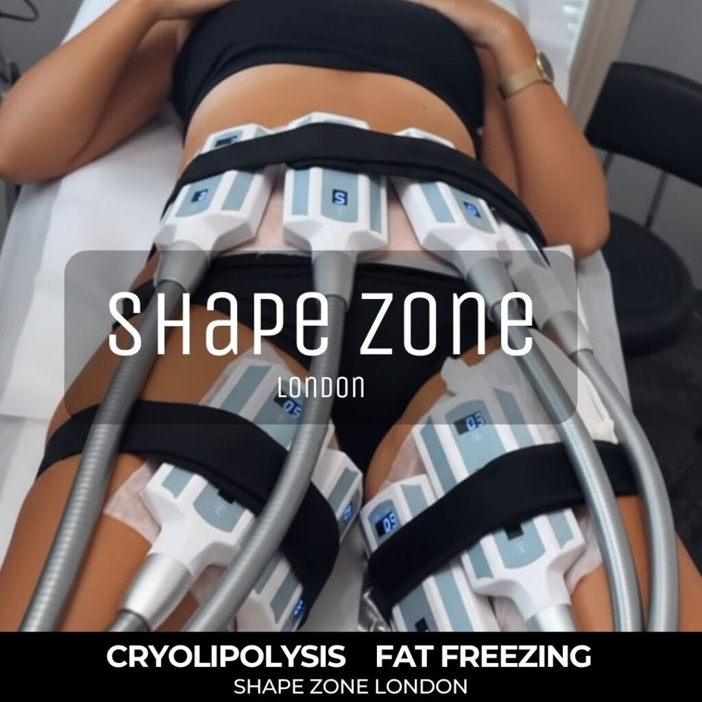 Cryogenic Lipolysis