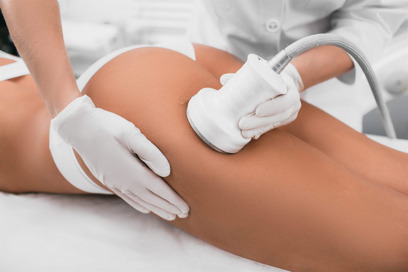 Laser Lipo at Shape Zone, London SW8