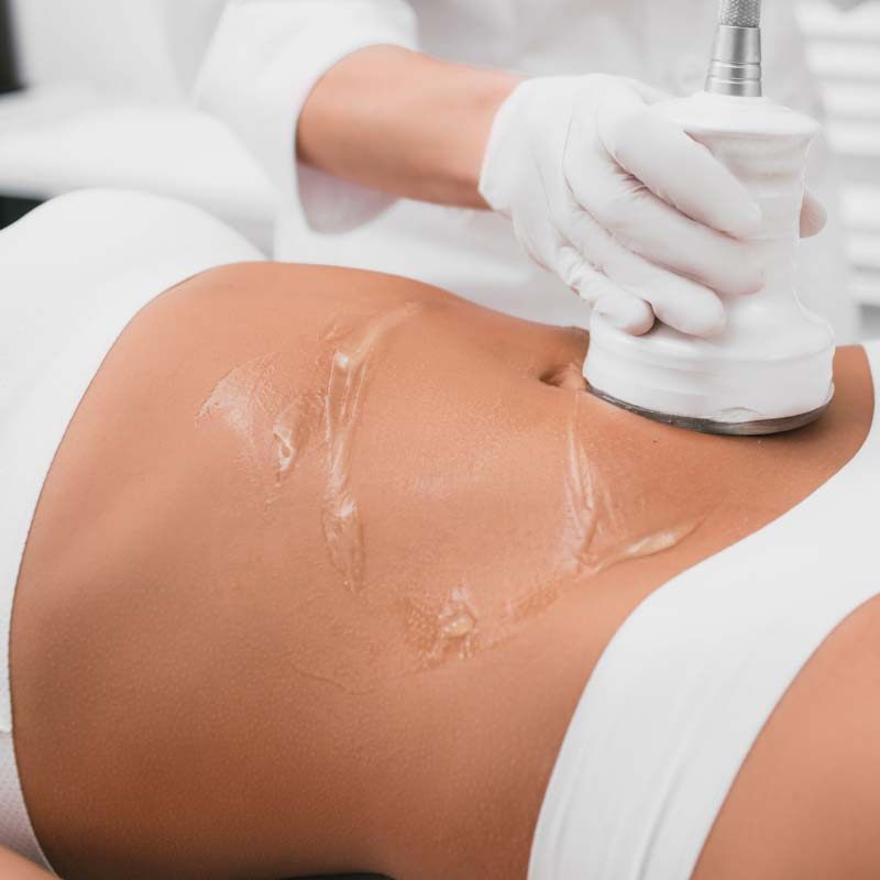 Cavitation at Shape Zone, London SW8