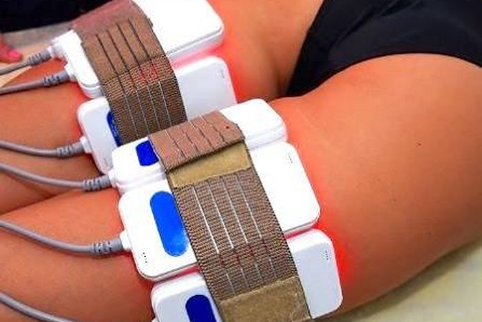 Laser Lipo at Shape Zone