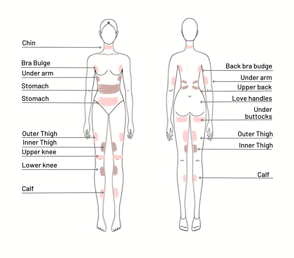 cryolipolysis in london body areas fat freezing